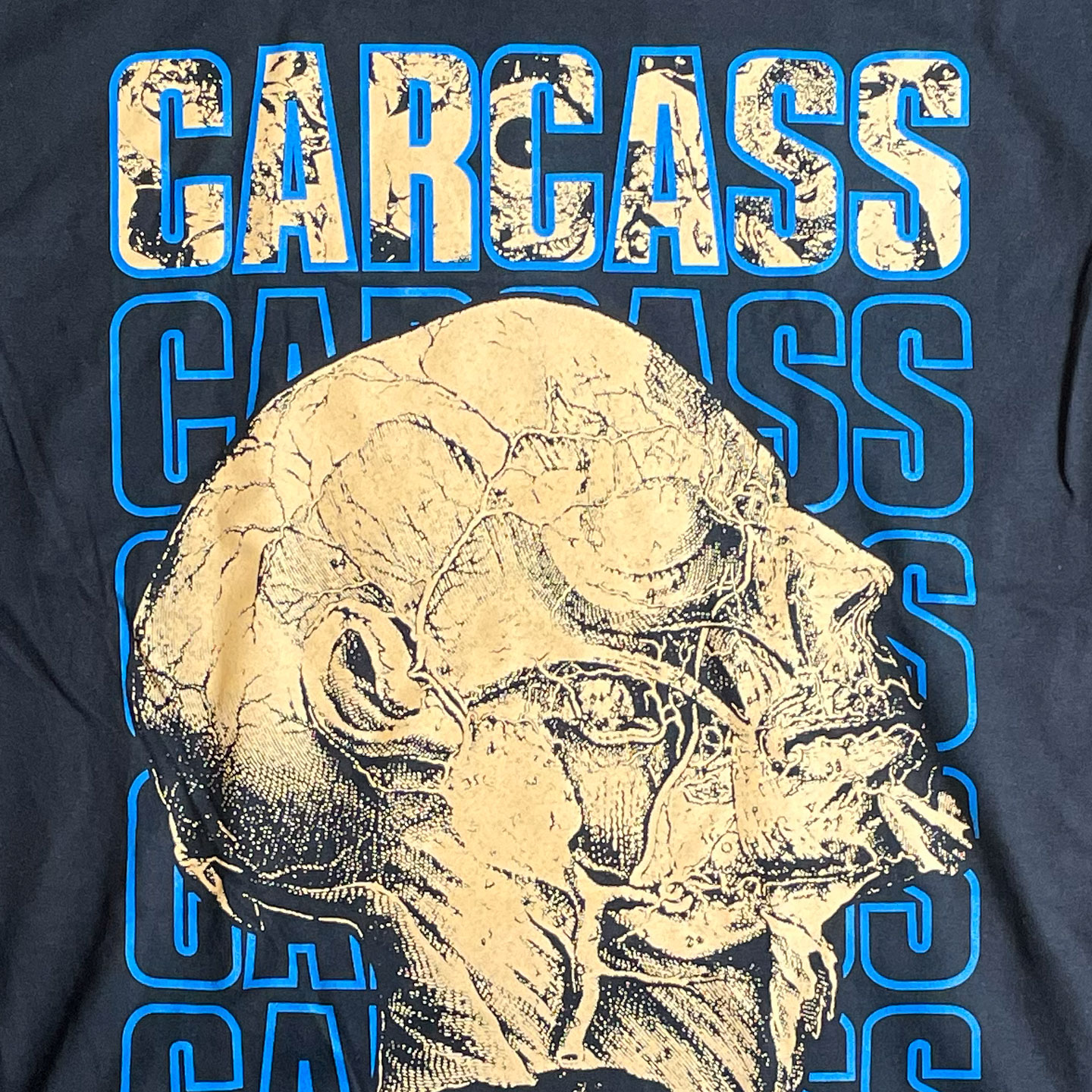 CARCASS Tシャツ オフィシャル！